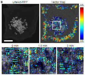 Actin waves revealed but STICS in a podosome cluster in immune dendritic cells